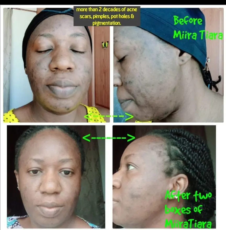 Miira-Tiara testimony